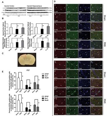 IL-33 Provides Neuroprotection through Suppressing Apoptotic, Autophagic and NF-κB-Mediated Inflammatory Pathways in a Rat Model of Recurrent Neonatal Seizure